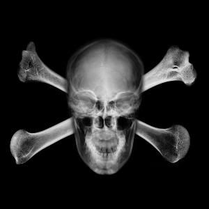 X-Ray Skull & Crossbones (300x300) Photo by BlindJimmy | Photobucket